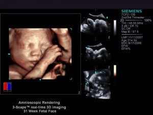 S2000 3D amnioscopic1