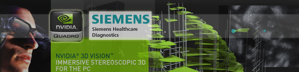 NVIDIA и Siemens Healthcare пренасят 3D възможностите на модерните киносалони и в лекарския кабинет
